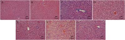 Preparation and efficacy of antibacterial methacrylate monomer-based polymethyl methacrylate bone cement containing N-halamine compounds